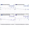 Kabel Mmcx do RPSMA/ACMMCXRPSMA Mikrotik