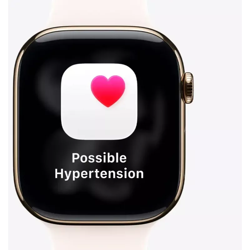 Smartwatch Apple Watch SE (3. generacja) GPS + Cellular 44mm Koperta z aluminium w kolorze Midnight