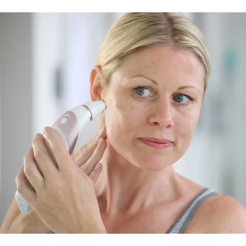 HoMedics Radiance urządzenie do pielęgnacji skóry Odsysacz skórny Mikrodermabrazja Różowe złoto, Biały