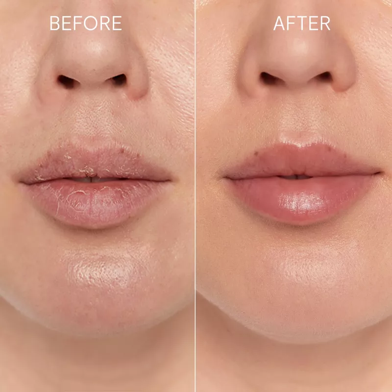 GLOV Scrubex Lip Exfoliating Mitt - 2 Pack | Delikatny mikrofibrowy peeling do ust dla gładkich ust