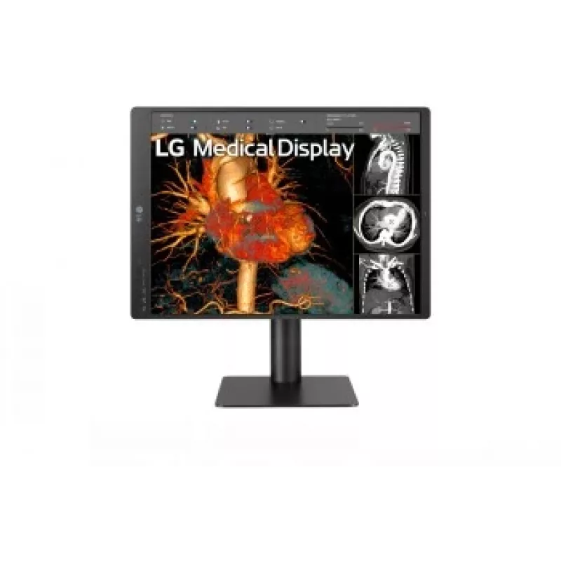 LG 21.3 inch 3MP IPS Diagnostic Monitor 21HQ513D-M