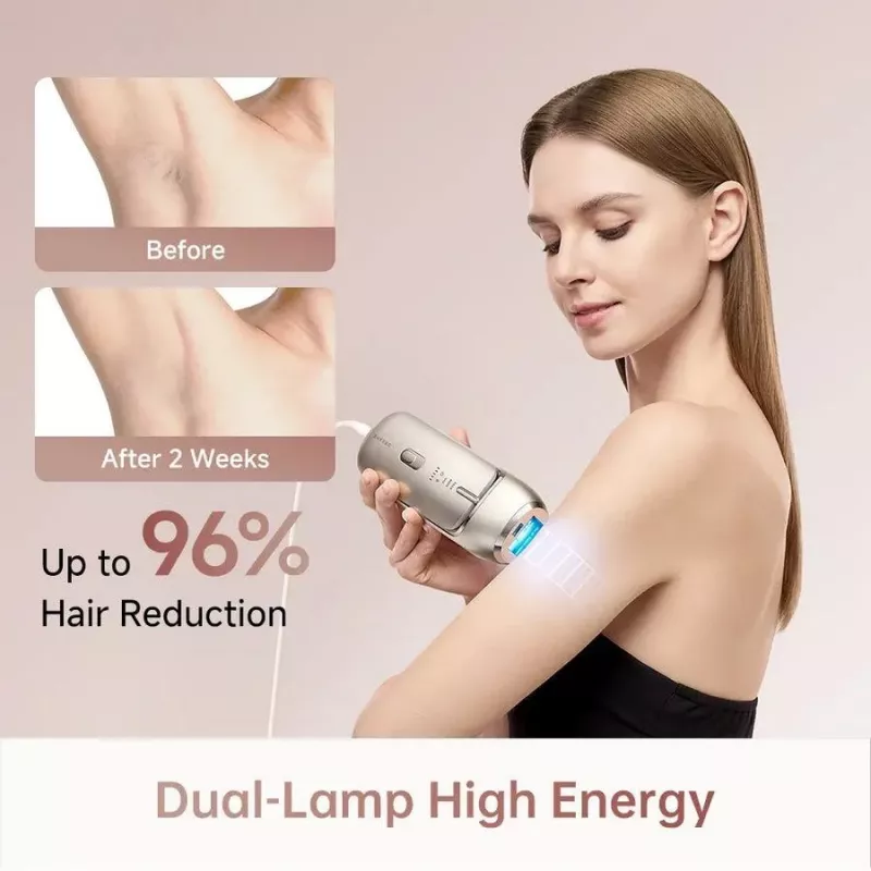 Dreame AHR01-GOLD IPL Urządzenie do usuwania włosów Nova Gold z 990 000 błysków, 5 poziomami energii, filtrem UV, zasilane sieciowo